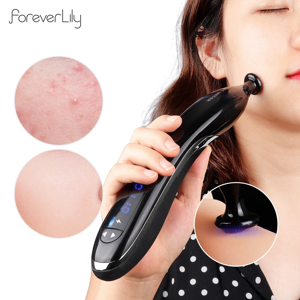 Blue Light Ozone Acne Treatment Machine Cold Plasma Skin Rejuvenation Plasma Pen for Acne Scar Wrinkle Removal jato de plasma
