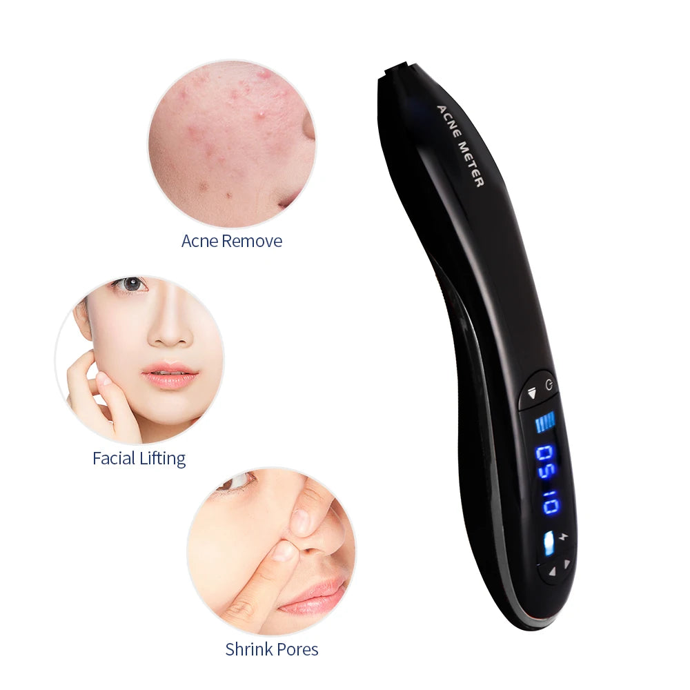 Blue Light Ozone Acne Treatment Machine Cold Plasma Skin Rejuvenation Plasma Pen for Acne Scar Wrinkle Removal jato de plasma