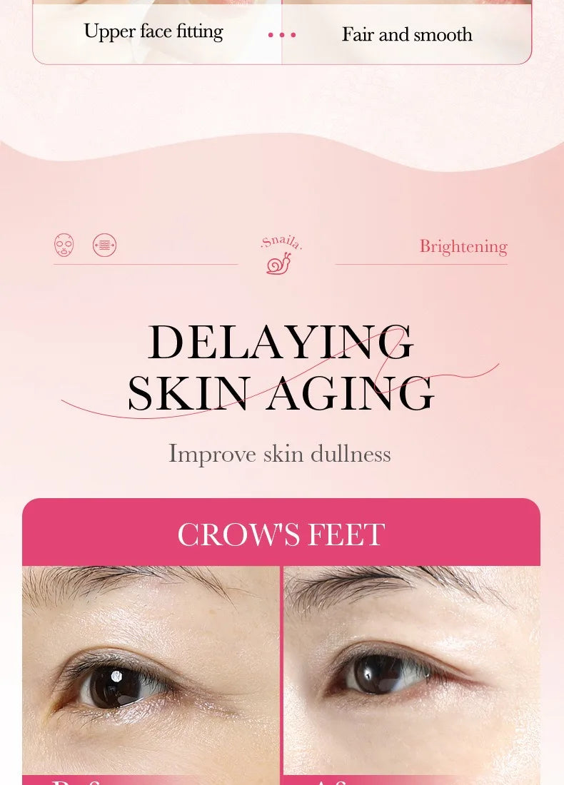 5/10 PCS Korean Snail Mucin Sheet Mask Hydrating Repair Brightening Anti-Aging Wrinkle Moisturizing Gel Face Mask for All Skin