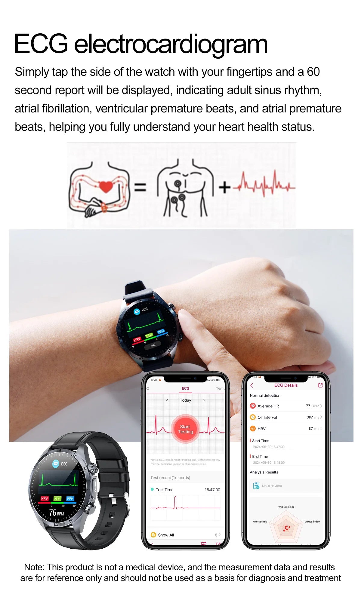 2026 New Pulse﻿ ECG+PPG Treatment Smart Watch Men Blood Lipid Uric Acid BP Body Fat Tired monitor Sports Health Call Smartwatch