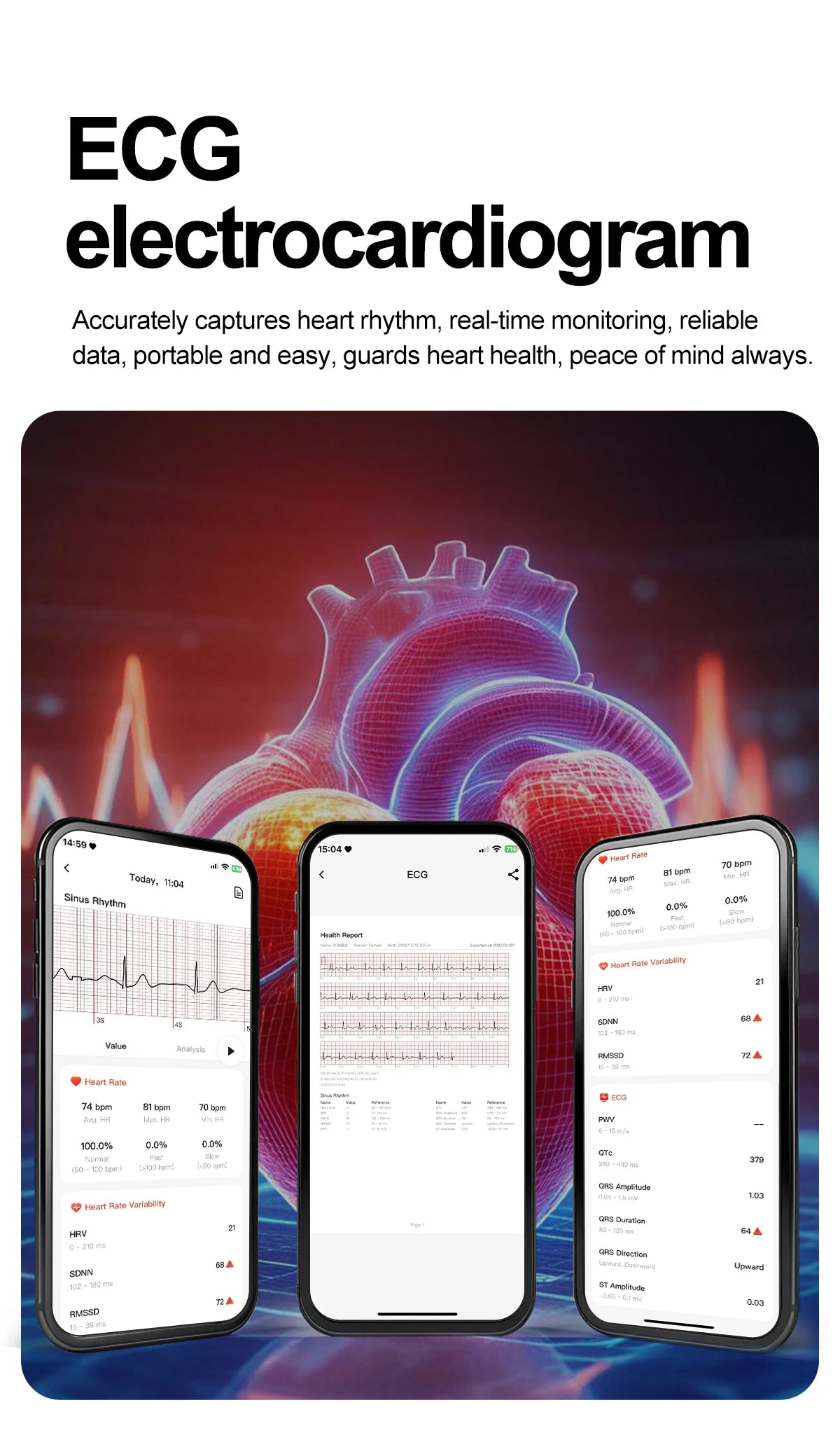 2025Nursing Level Uric Acid Blood lipids Smart Watch Men Blood Pressure ECG+PPG Clock Body Analysis Voice Call Health Smartwatch