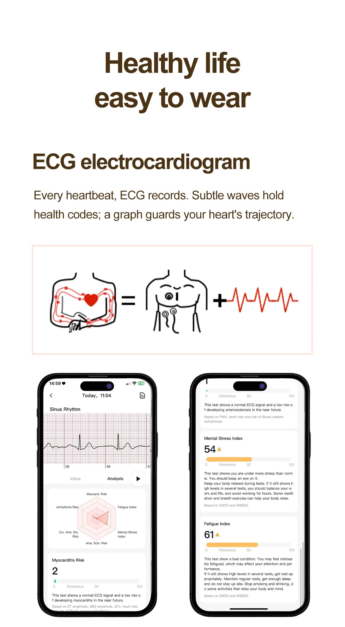 2026 New Women AI Smart Diagnosis Smart Watch HRV+ECG Uric Acid Blood Oxygen Health Monitor IP68 Waterproof Sports Smartwatches