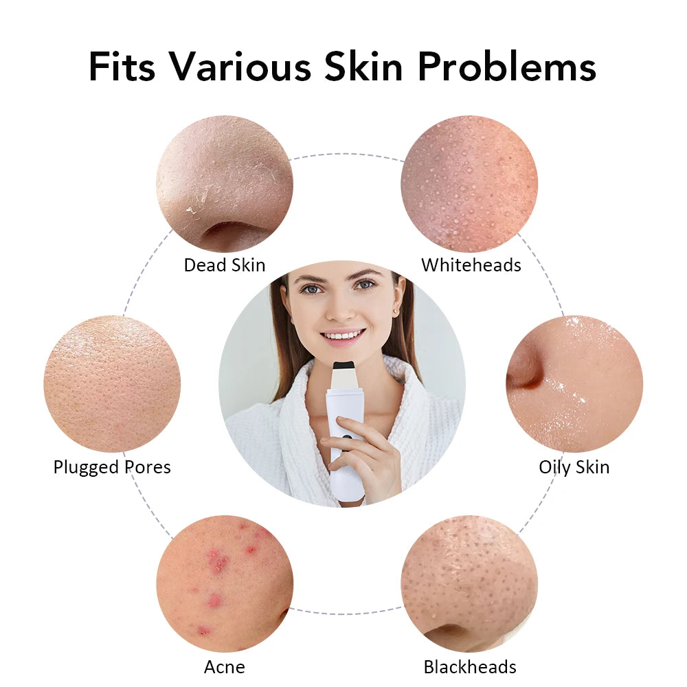 Ultrasonic Skin Scrubber Peeling Blackhead Remover Deep Face Cleaning Ultrasonic Ion Acne Pore Cleaner Facial Shovel  Scrubber