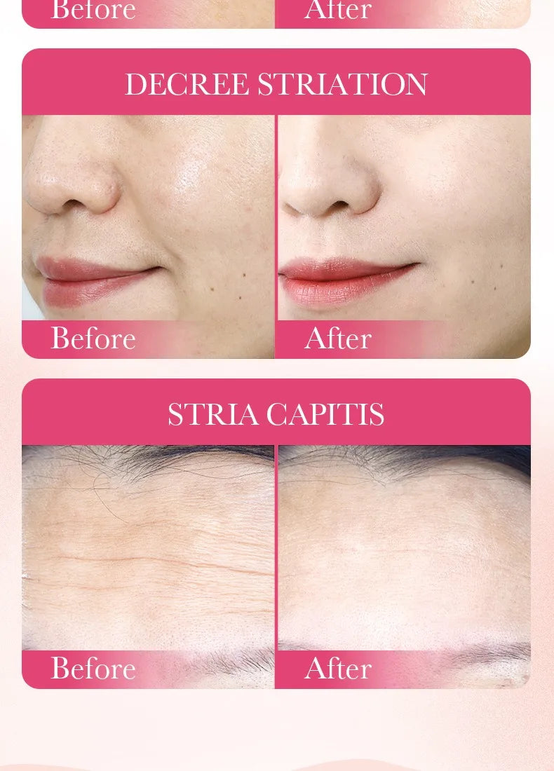 5/10 PCS Korean Snail Mucin Sheet Mask Hydrating Repair Brightening Anti-Aging Wrinkle Moisturizing Gel Face Mask for All Skin