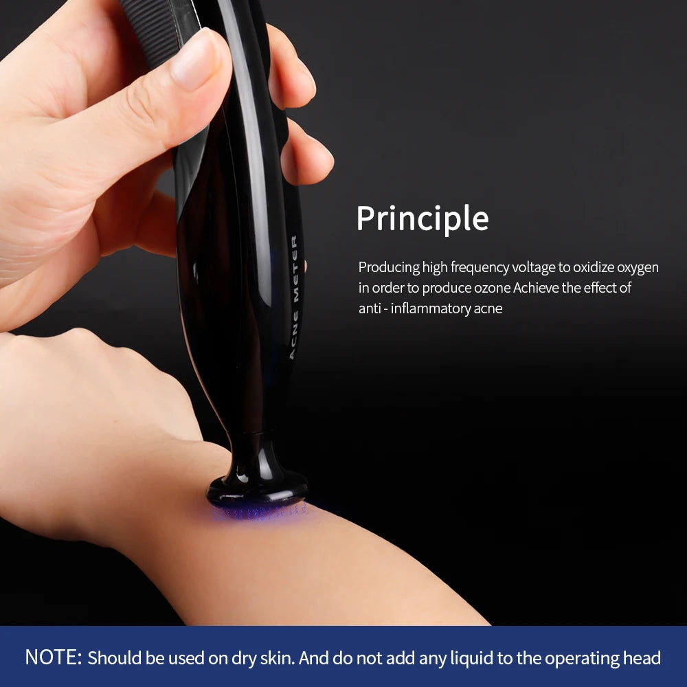 Blue Light Ozone Acne Treatment Machine Cold Plasma Skin Rejuvenation Plasma Pen for Acne Scar Wrinkle Removal jato de plasma