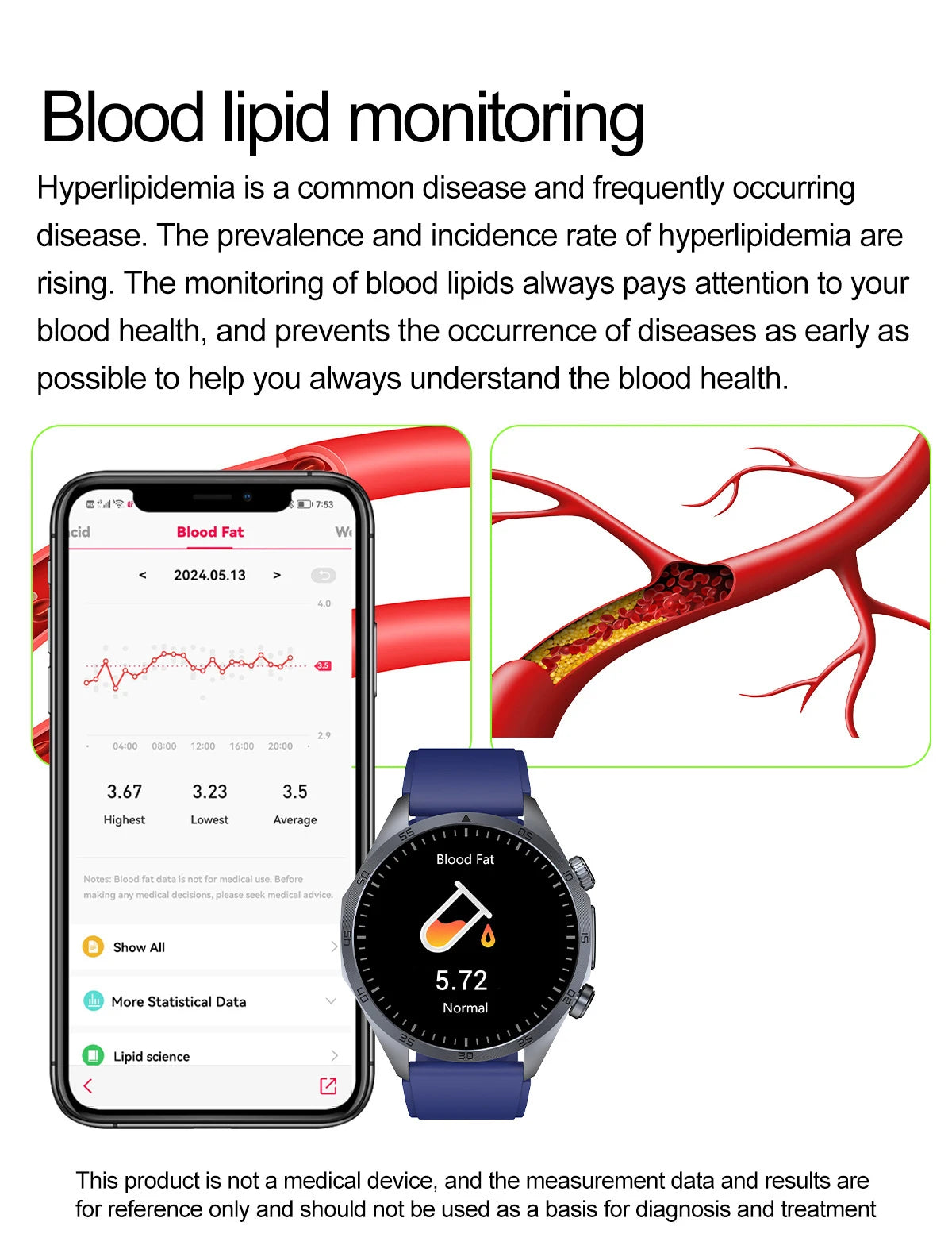 2026 New Pulse﻿ ECG+PPG Treatment Smart Watch Men Blood Lipid Uric Acid BP Body Fat Tired monitor Sports Health Call Smartwatch