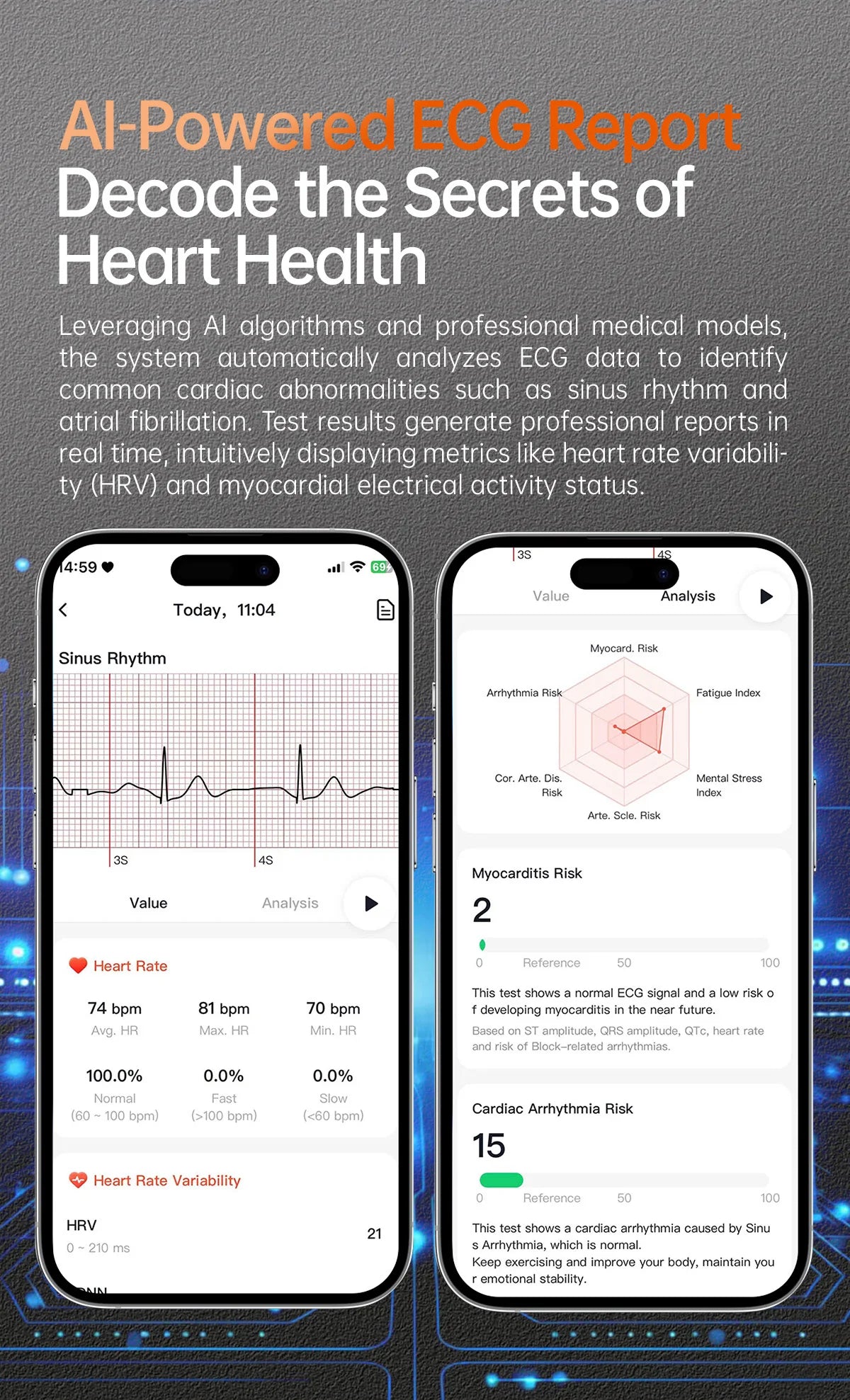 New ECG+PPG Health Diagnosis Smartwatches Men Women Clock Uric Acid Lipid BP Heart rate Tracker NFC Sports Smart Watch IOS