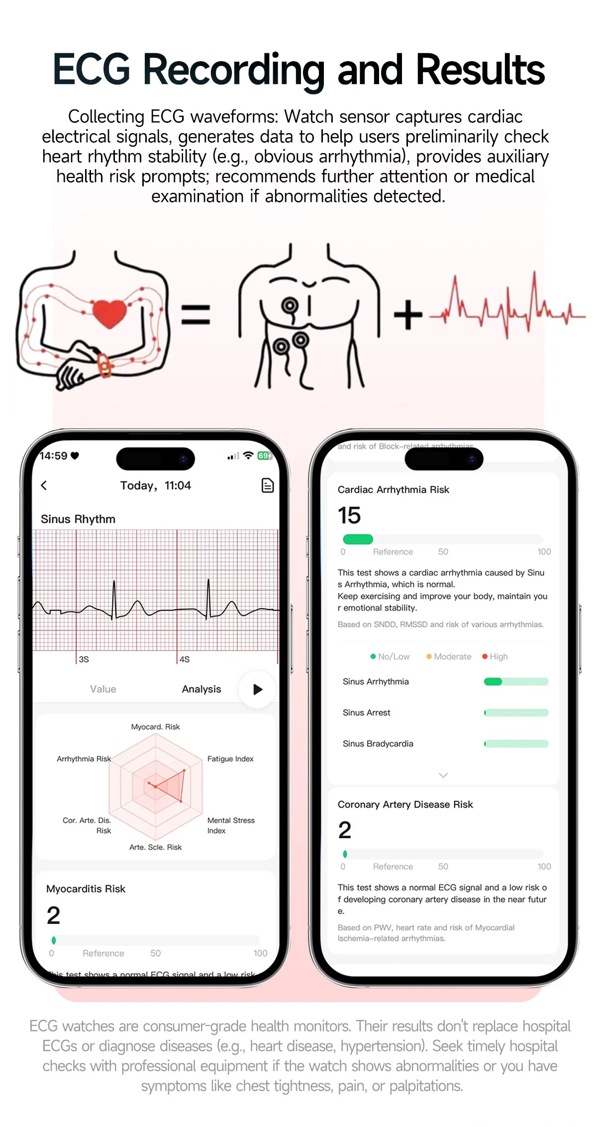 2026 New ECG+PPG Healthy Diagnose Smart Watch Men Body analysis Blood Pressure Lipid Uric Acid Women's Health Tracker Smartwatch