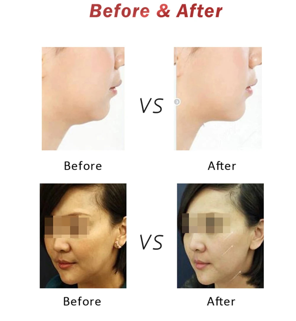 Mini Hifu Ultrasonic RF Facial Massager Lifting Wrinkle Removal Line V-Shape Anti-Aging Skin Tightening Face Care Beauty Device